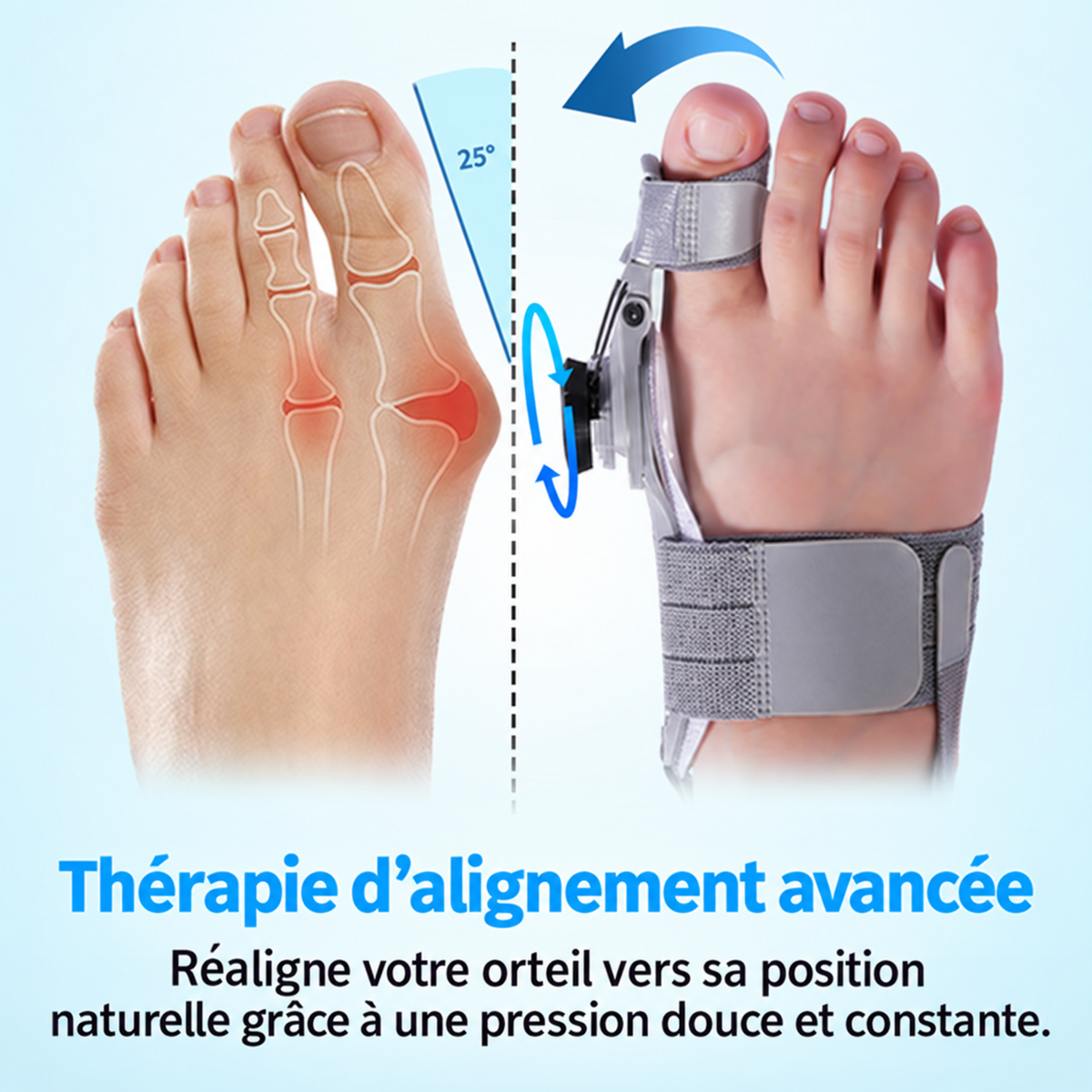 TreatMedy™  Correcteur d’Hallux Valgus